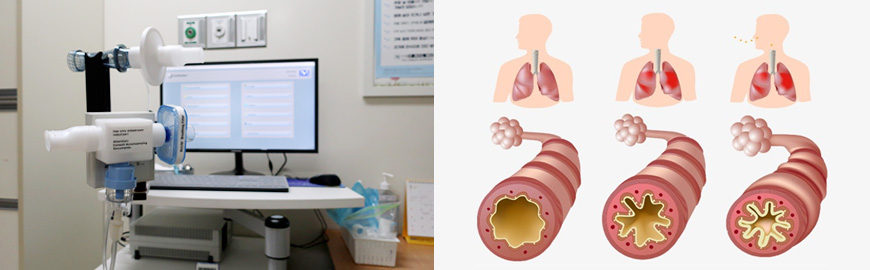 기관지 유발 검사기기, 폐기능(좋음, 중간, 나쁨)에 따라 나타나는 기도관 단면